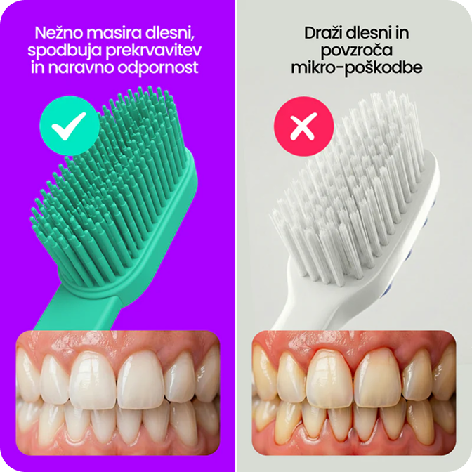 Najlon poškoduje dlesni