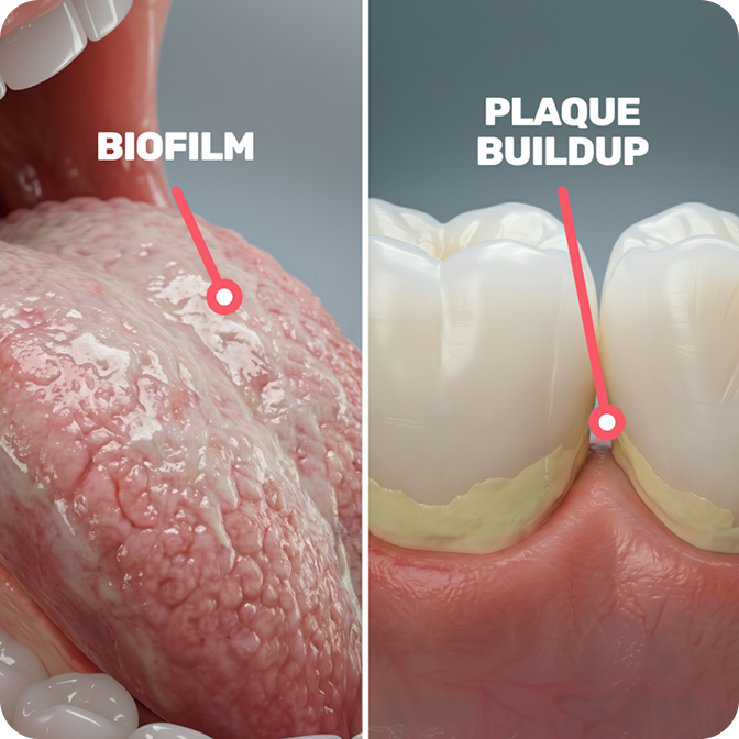 Hidden bacterial reservoirs keep the mouth acidic