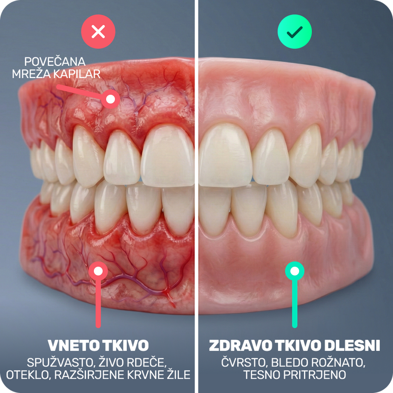 Vnetje se začne, še preden ga opaziš