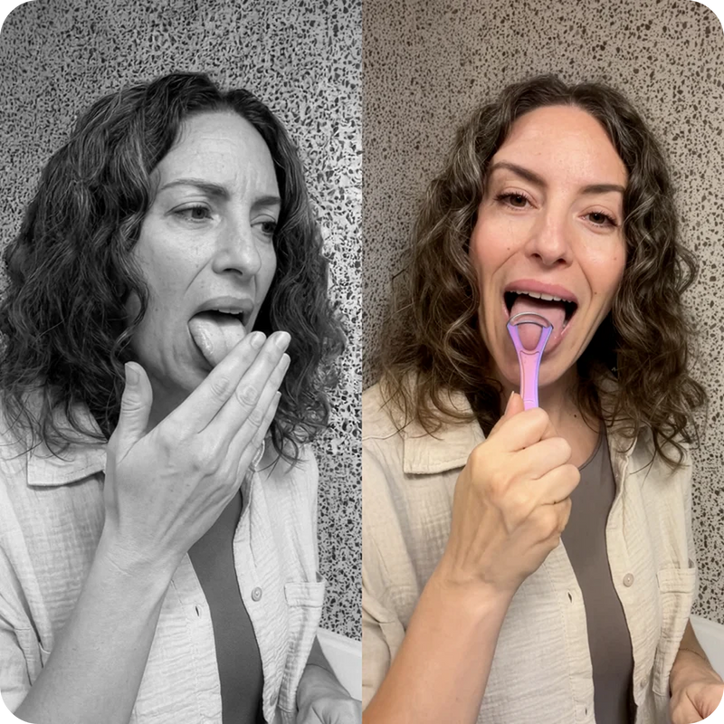 BAD BREATH STARTS ON THE TONGUE